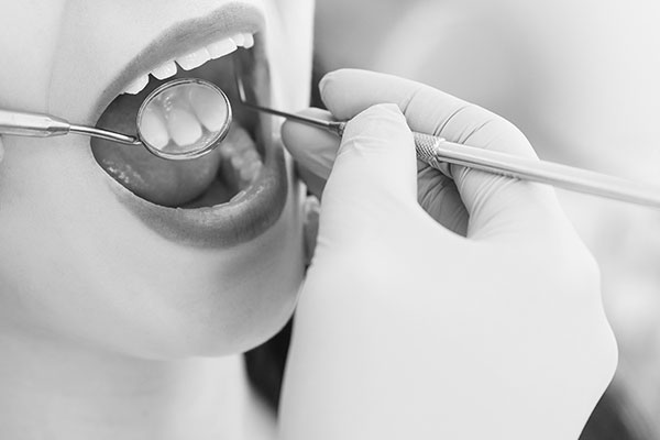 Dental Cleanings | Flanigan Dentistry | Denver Dentist